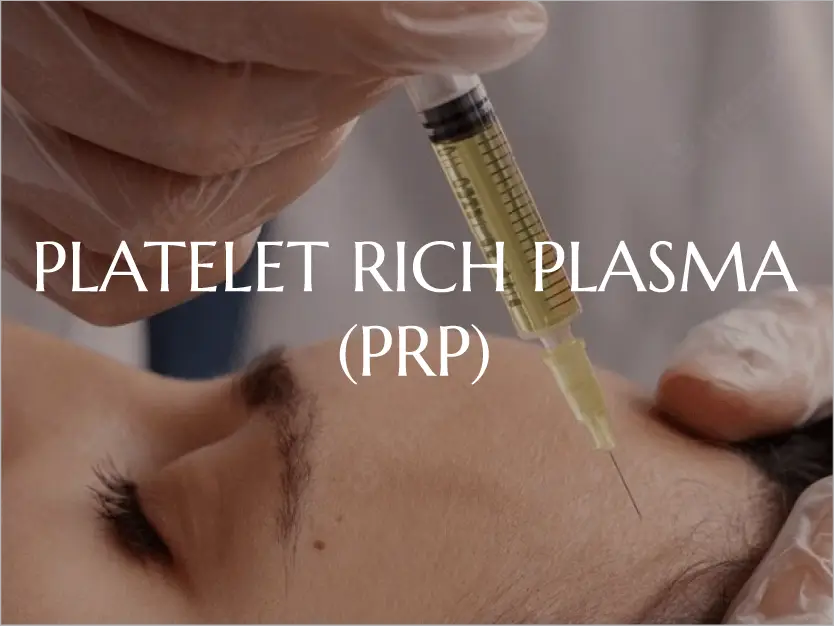 Platelet Rich Plasma (PRP) Facial