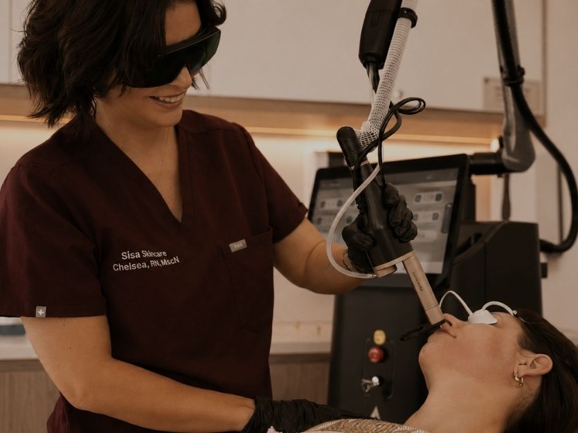 Alma Hybrid laser resurfacing treatment at Sisä Skincare in Freshwater, Northern Beaches