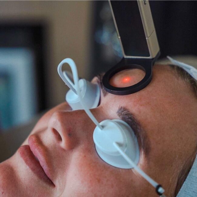 Illustration showing the skin concerns treated with Alma Hybrid laser skin rejuvenation, including pigmentation, sun damage, fine lines, wrinkles, acne scarring, skin texture, enlarged pores and skin laxity at Sisä Skincare in Freshwater, Sydney.