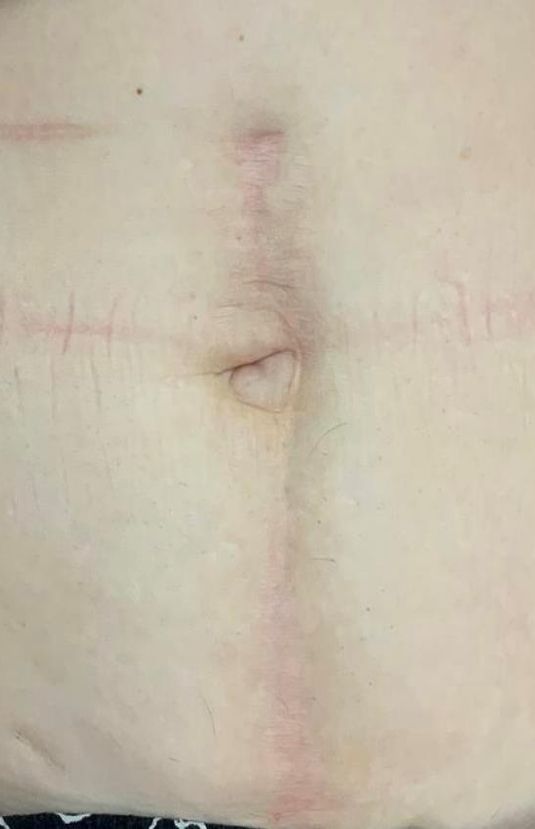 morpheus8 sydney botox filler laser IPL LED skincare northern beaches freshwater microneedling skin treatments clinic 11 morpheus8 sydney botox filler laser IPL LED skincare northern beaches freshwater microneedling skin treatments clinic