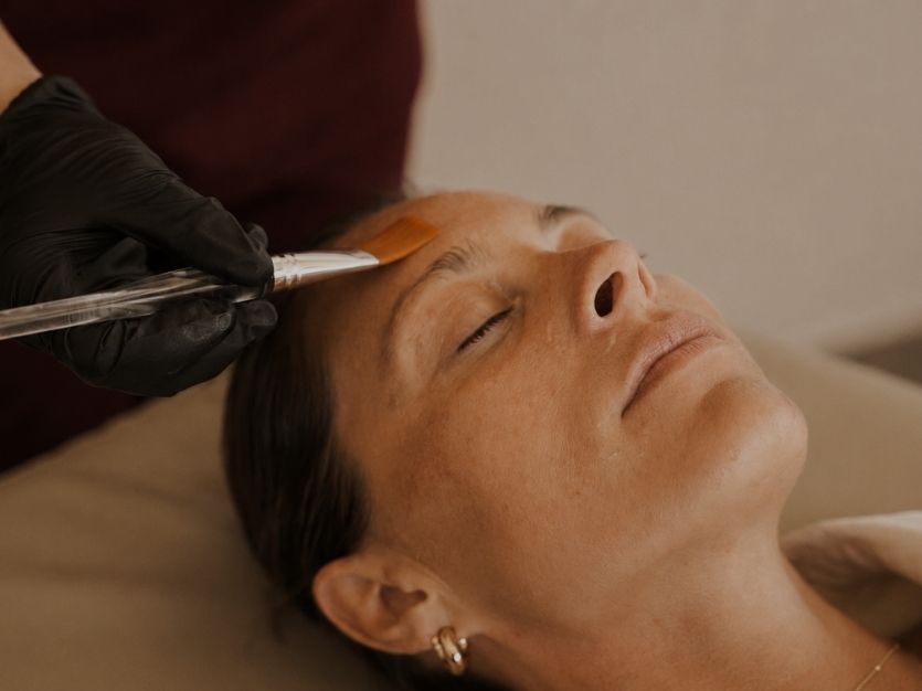 ASCE+ exosome therapy treatment at Sisä Skincare in Freshwater, Northern Beaches