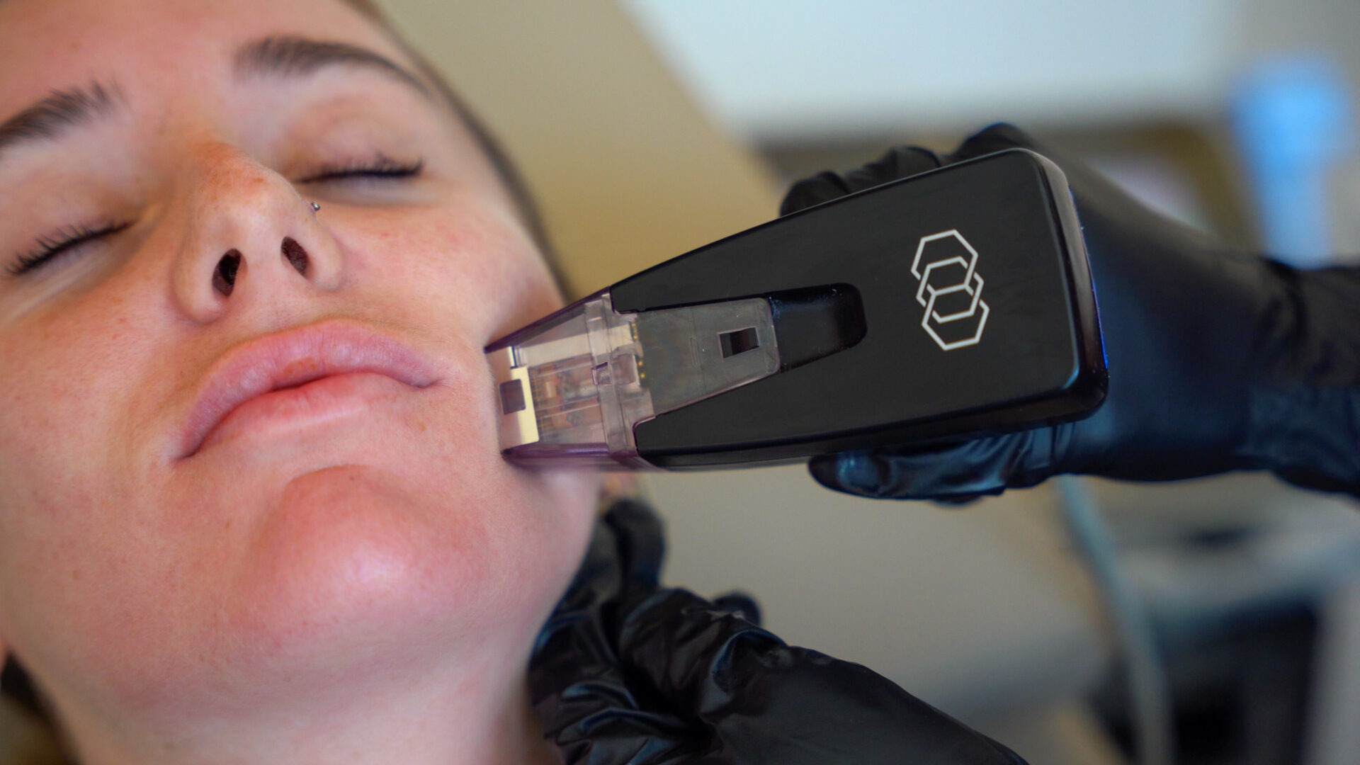 morpheus8 sydney botox filler laser IPL LED skincare northern beaches freshwater microneedling skin treatments clinic