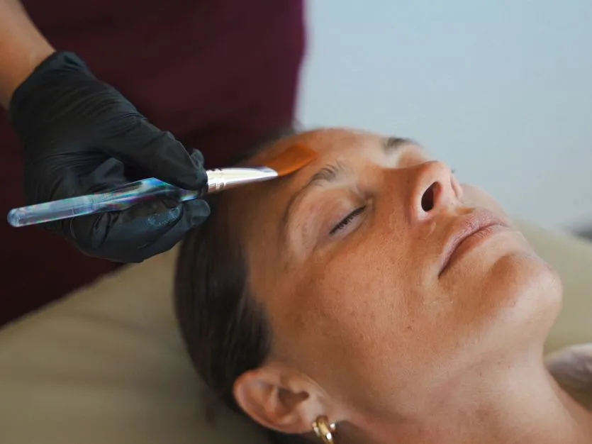 ASCE+ exosome therapy treatment at Sisä Skincare in Freshwater, Northern Beaches