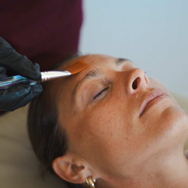 Patient receiving an Exosome Skin Treatment at Sisä Skincare in Freshwater on Sydney's Northern Beaches.