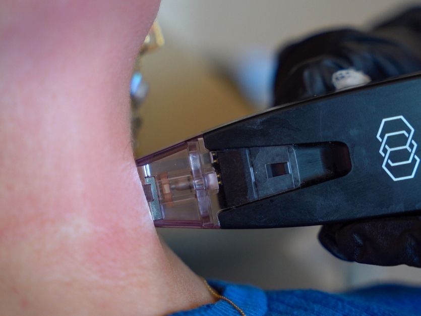 morpheus8 sydney botox filler laser IPL LED skincare northern beaches freshwater microneedling skin treatments clinic 7 Patient receiving a Morpheus8 neck treatment at Sisä Skincare in Freshwater on Sydney's Northern Beaches.