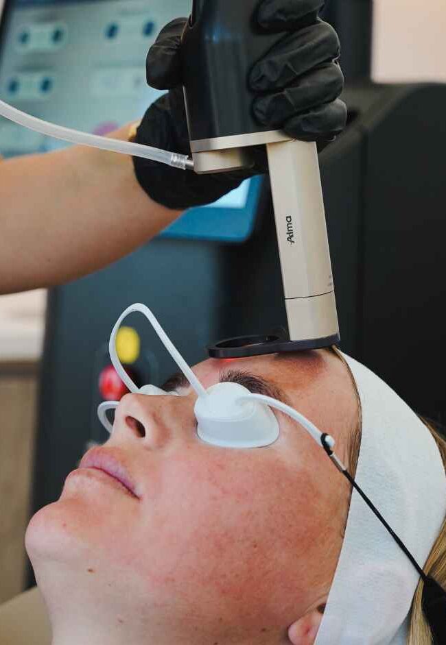 Performing PixelPeel fractional CO₂ laser resurfacing on the Alma Hybrid at Sisä Skincare, Freshwater